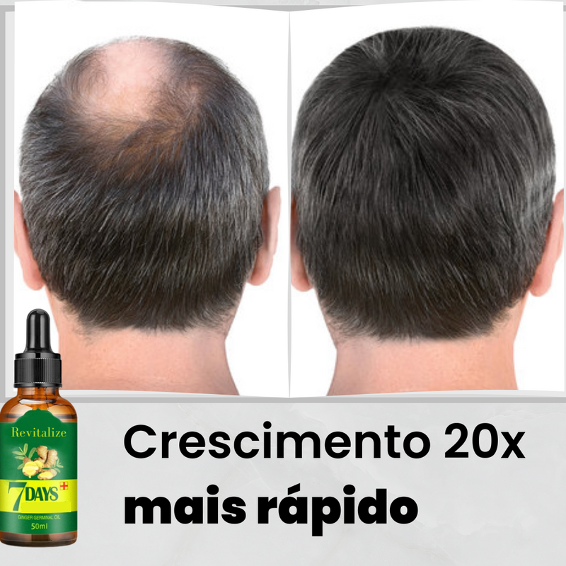 Serum King Hair®️ | Aumenta Crescimento 20x Anti-Queda e Fortalece 95%