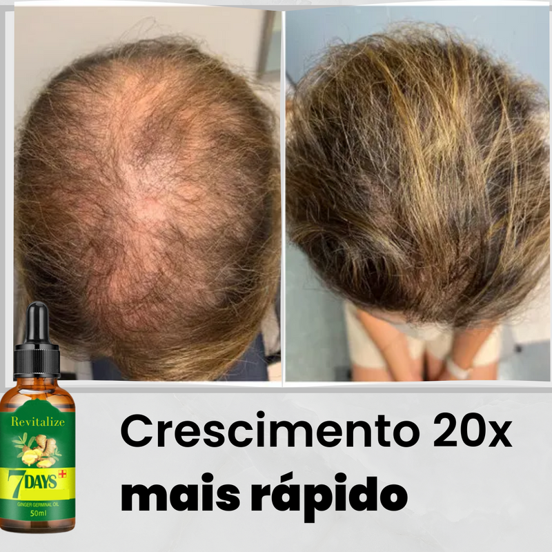 Serum King Hair®️ | Aumenta Crescimento 20x Anti-Queda e Fortalece 95%