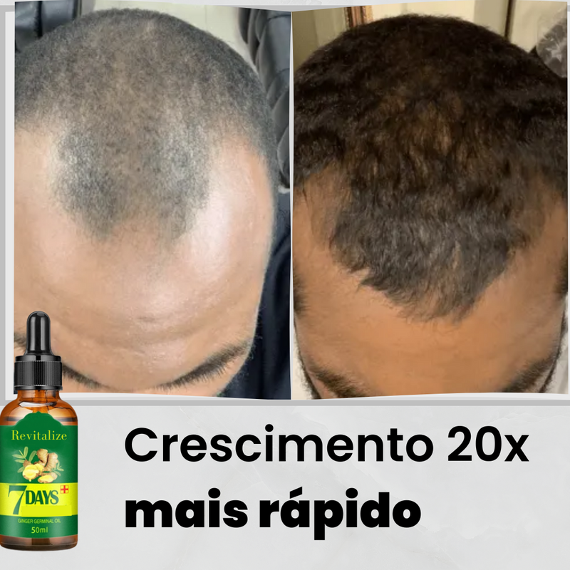 Serum King Hair®️ | Aumenta Crescimento 20x Anti-Queda e Fortalece 95%