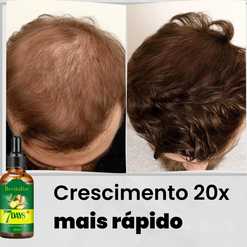 Serum King Hair®️ | Aumenta Crescimento 20x Anti-Queda e Fortalece 95%