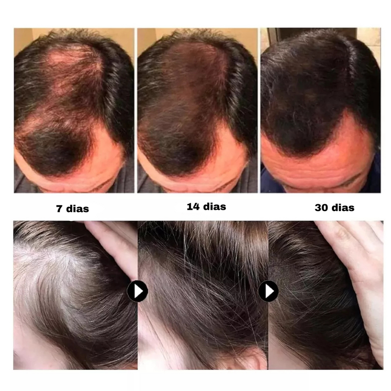 Novo Óleo OCHEAL De Batana Orgânico Para O Crescimento Do Cabelo