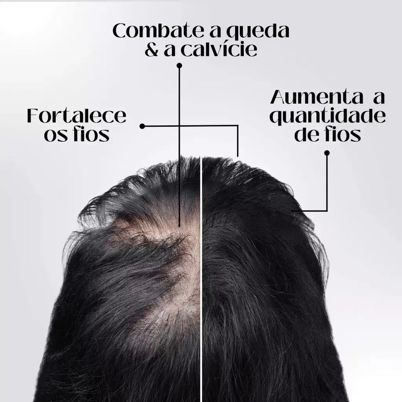 Serum King Hair®️ | Aumenta Crescimento 20x Anti-Queda e Fortalece 95%