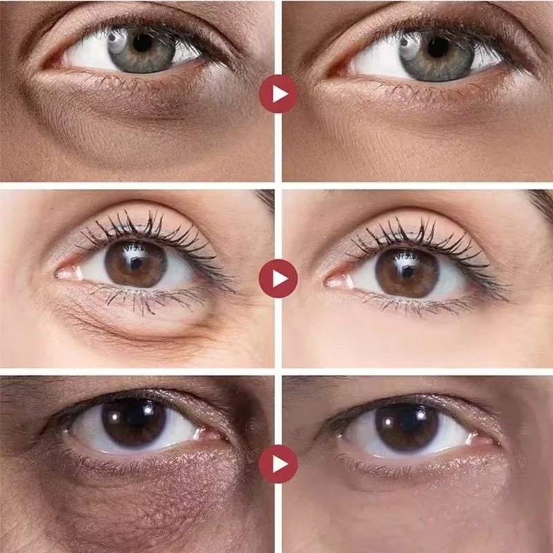Rolon 5 em 1 Ultra Rejuvenescedor Luteína Glow®